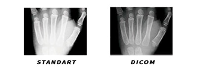 Режим изображения DICOM в проекторах Boxlight